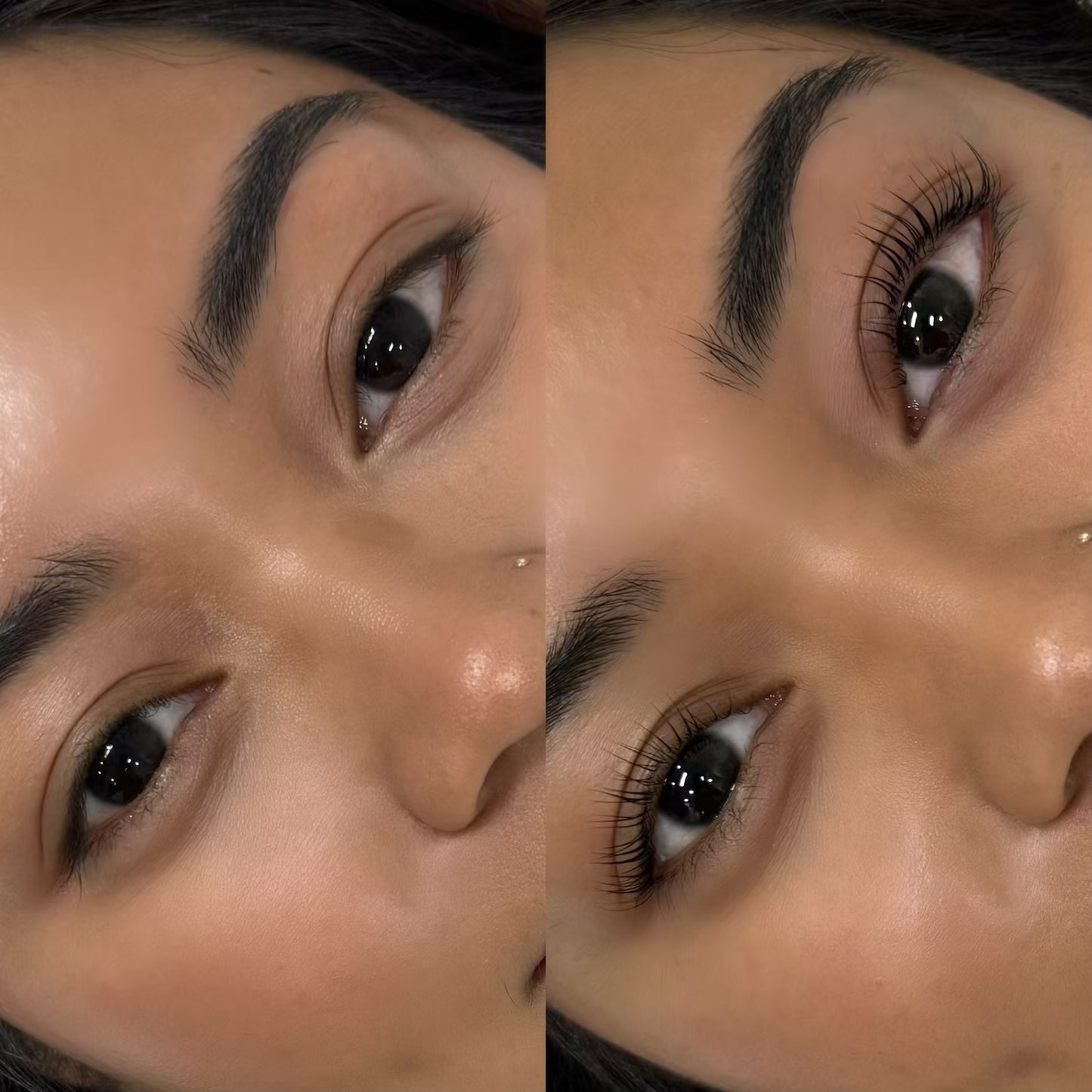 Lash Botox Infusion