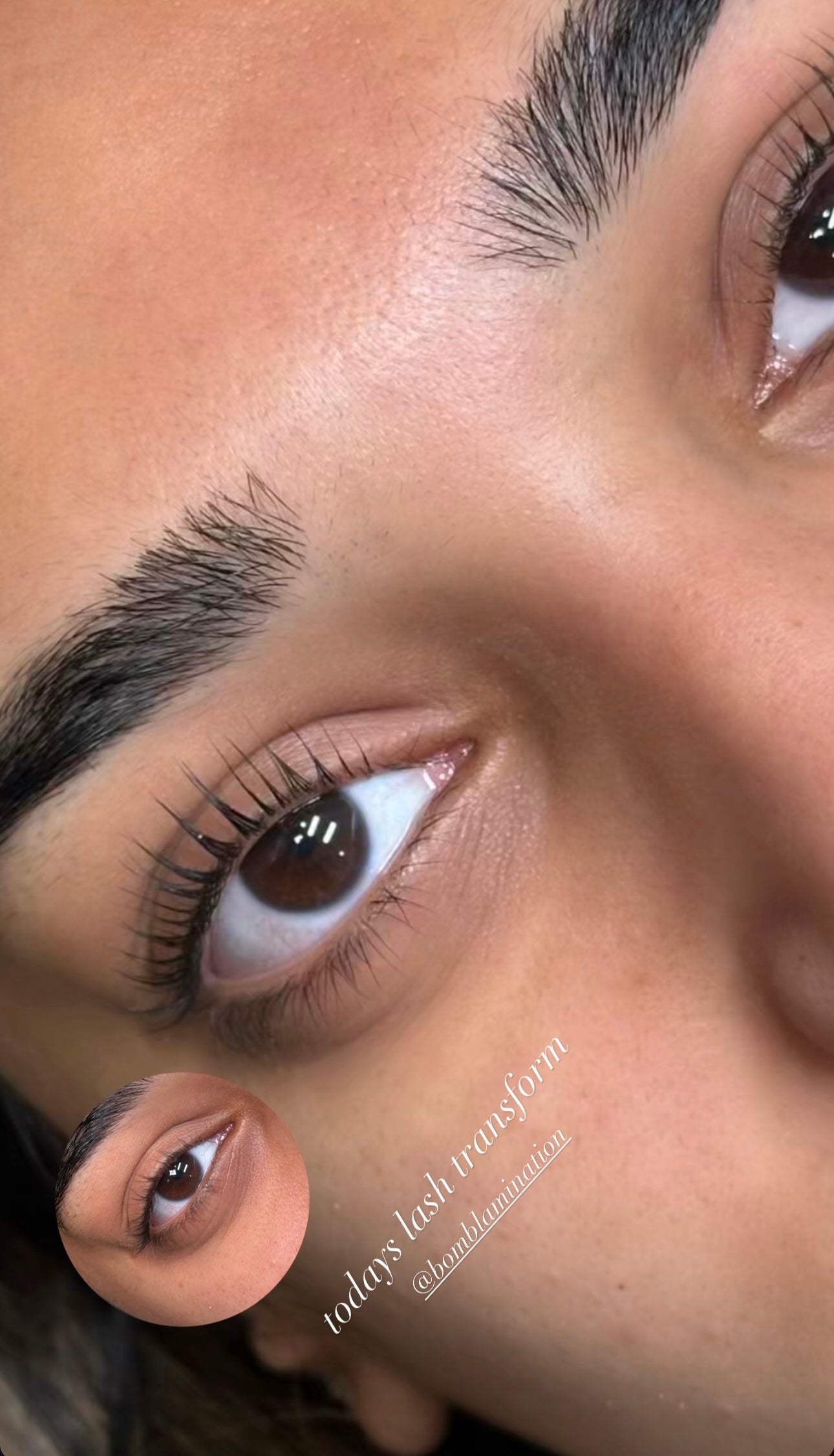 Lash Botox Infusion