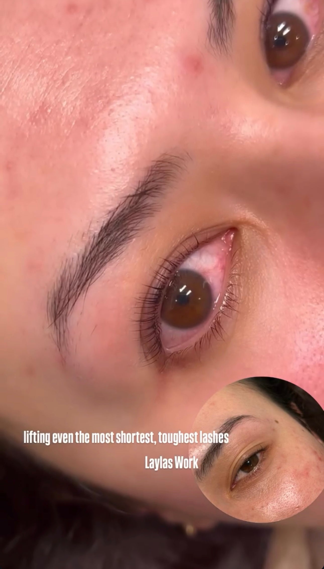 Lash Botox Infusion