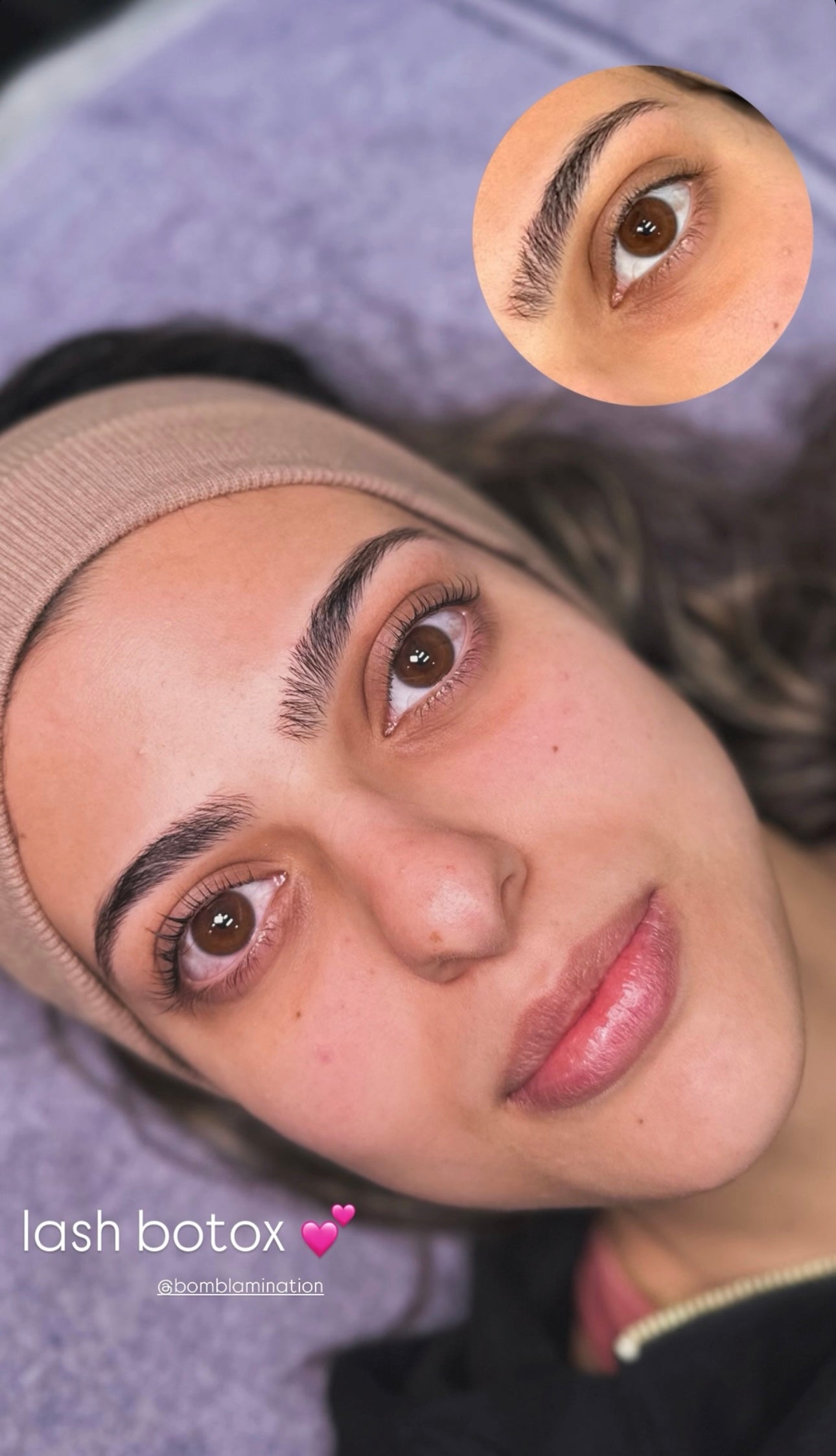 Lash Botox Infusion